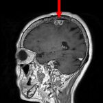 No.’25_89　手術前1