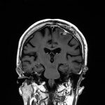 No.’25_89　手術前2