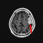 No.’26_21　手術前1