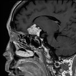 No.’26_19　手術前2