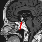 No.’25_96　手術前1