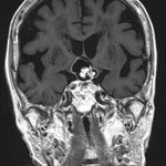 No.’25_96　手術前2