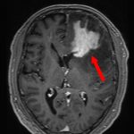 No.’25_95　手術前1