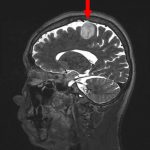 No.’25_101　手術前1