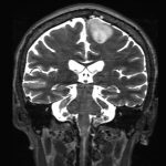 No.’25_101　手術前2