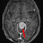 No.’25_109　手術前1