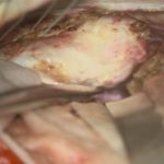 No.’25_109　摘出 前