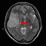 No.’25_104　手術前1