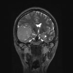 No.’25_104　手術前2