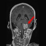 No.’25_103　手術前1