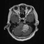 No.’25_103　手術前2