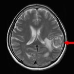 No.’25_106　手術前1