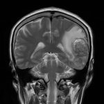 No.’25_106　手術前2