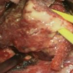 No.’25_106　 摘出 中