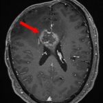 No.’26_9　手術前1