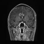 No.’26_9　手術前2