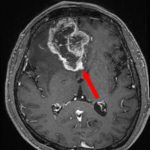 No.’25_116　手術前1