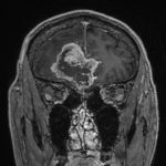 No.’25_116　手術前2