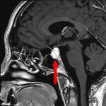 No.’26_2　手術前1