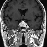 No.’26_2　手術前2