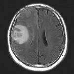 No.’25_115　手術前1