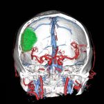 No.’25_115　手術前2