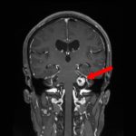 No.’26_14　手術前1