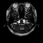 No.’26_14　手術前2