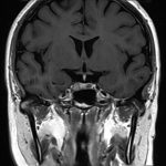 No.’26_7　手術前2