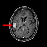 No.’26_8　手術前1