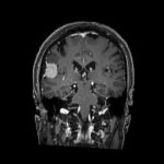 No.’26_8　手術前2