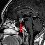No.’26_15　手術前1