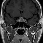 No.’26_15　手術前2