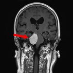 No.’26_6　手術前1