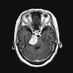 No.’26_6　手術前2