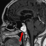 No.’26_10　手術前1