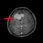No.’26_16　手術前1