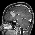 No.’26_16　手術前2