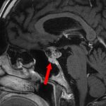 No.’26_20　手術前1