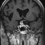 No.’26_20　手術前2