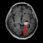 No.’26_22　手術前1