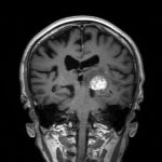 No.’26_22　手術前2