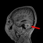 No.’26_18　手術前1