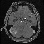 No.’26_18　手術前2
