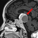 No.’26_23　手術前1
