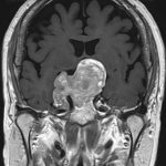 No.’26_23　手術前2