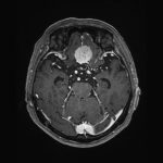 No.’26_78　手術前2